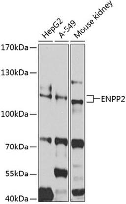 Western blot - ENPP2 antibody (A2522)