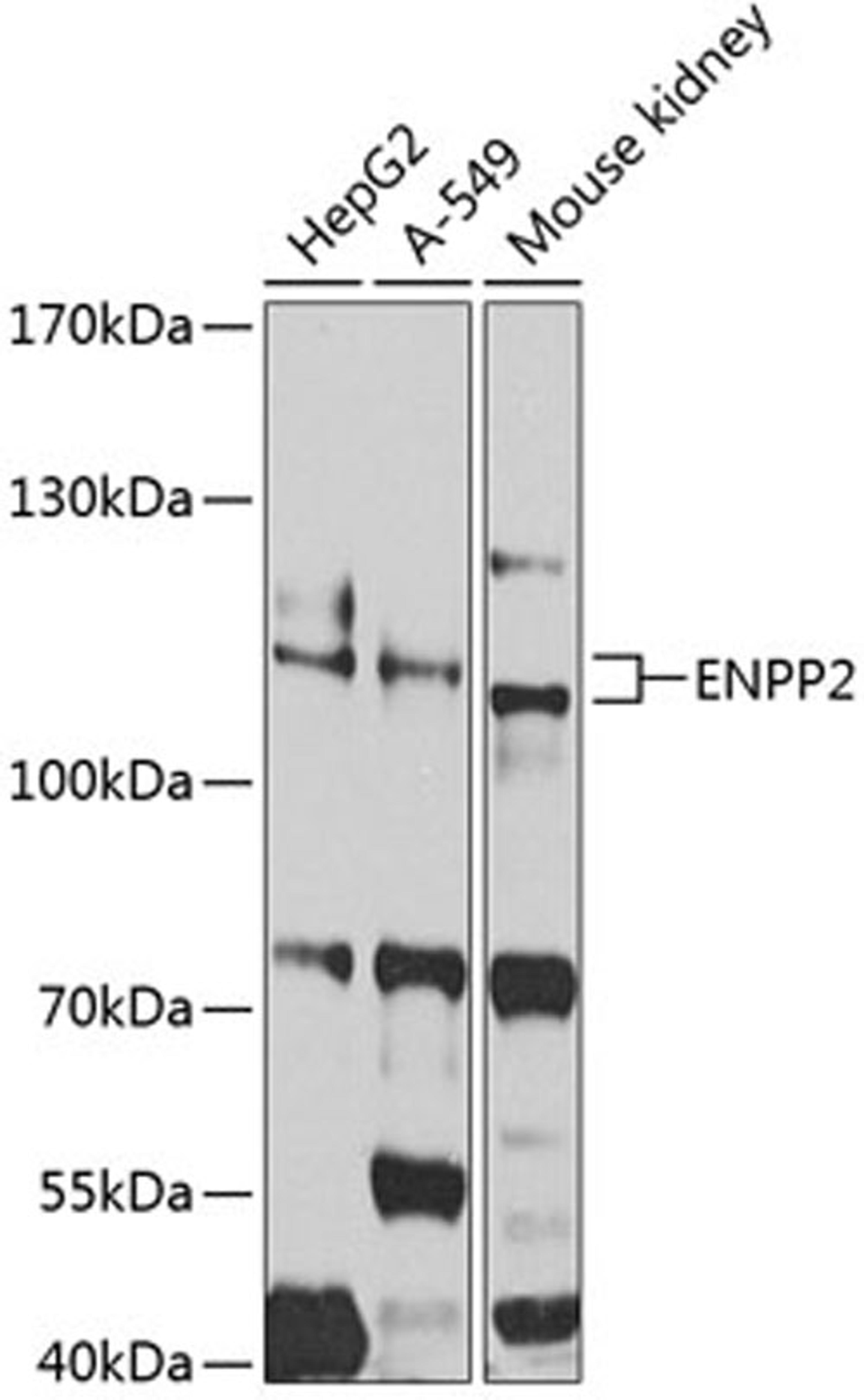 Western blot - ENPP2 antibody (A2522)