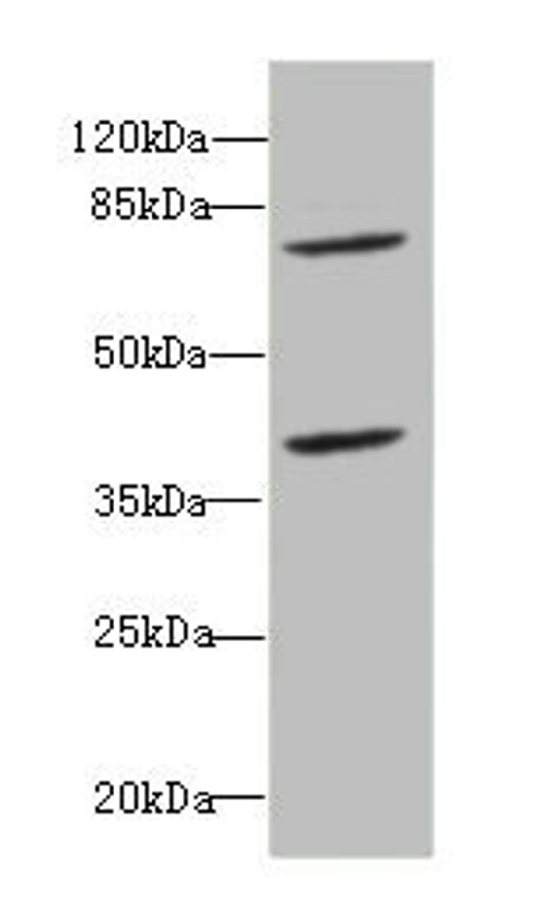 Western blot. All lanes: CBFA2T2antibody at 2.45ug/ml + Raji whole cell lysate. Secondary. Goat polyclonal to rabbit IgG at 1/10000 dilution. Predicted band size: 68, 64, 29, 66 kDa. Observed band size: 68, 40 kDa. 