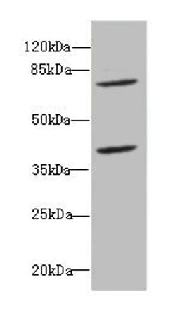 Western blot. All lanes: CBFA2T2antibody at 2.45ug/ml + Raji whole cell lysate. Secondary. Goat polyclonal to rabbit IgG at 1/10000 dilution. Predicted band size: 68, 64, 29, 66 kDa. Observed band size: 68, 40 kDa. 