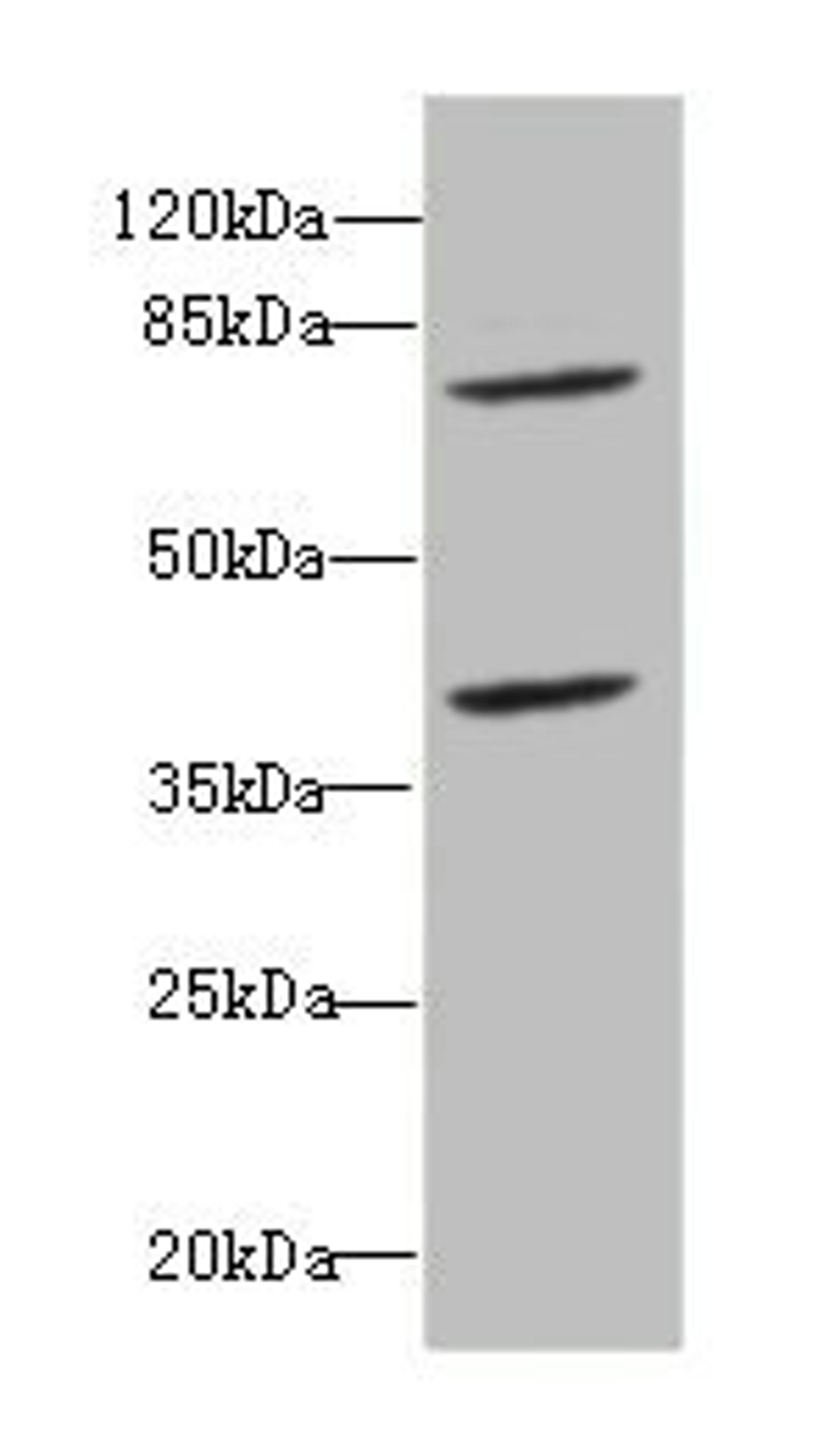 Western blot. All lanes: CBFA2T2antibody at 2.45ug/ml + Raji whole cell lysate. Secondary. Goat polyclonal to rabbit IgG at 1/10000 dilution. Predicted band size: 68, 64, 29, 66 kDa. Observed band size: 68, 40 kDa. 