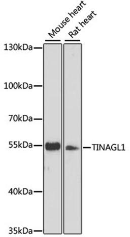 Western blot - TINAGL1 antibody (A13122)