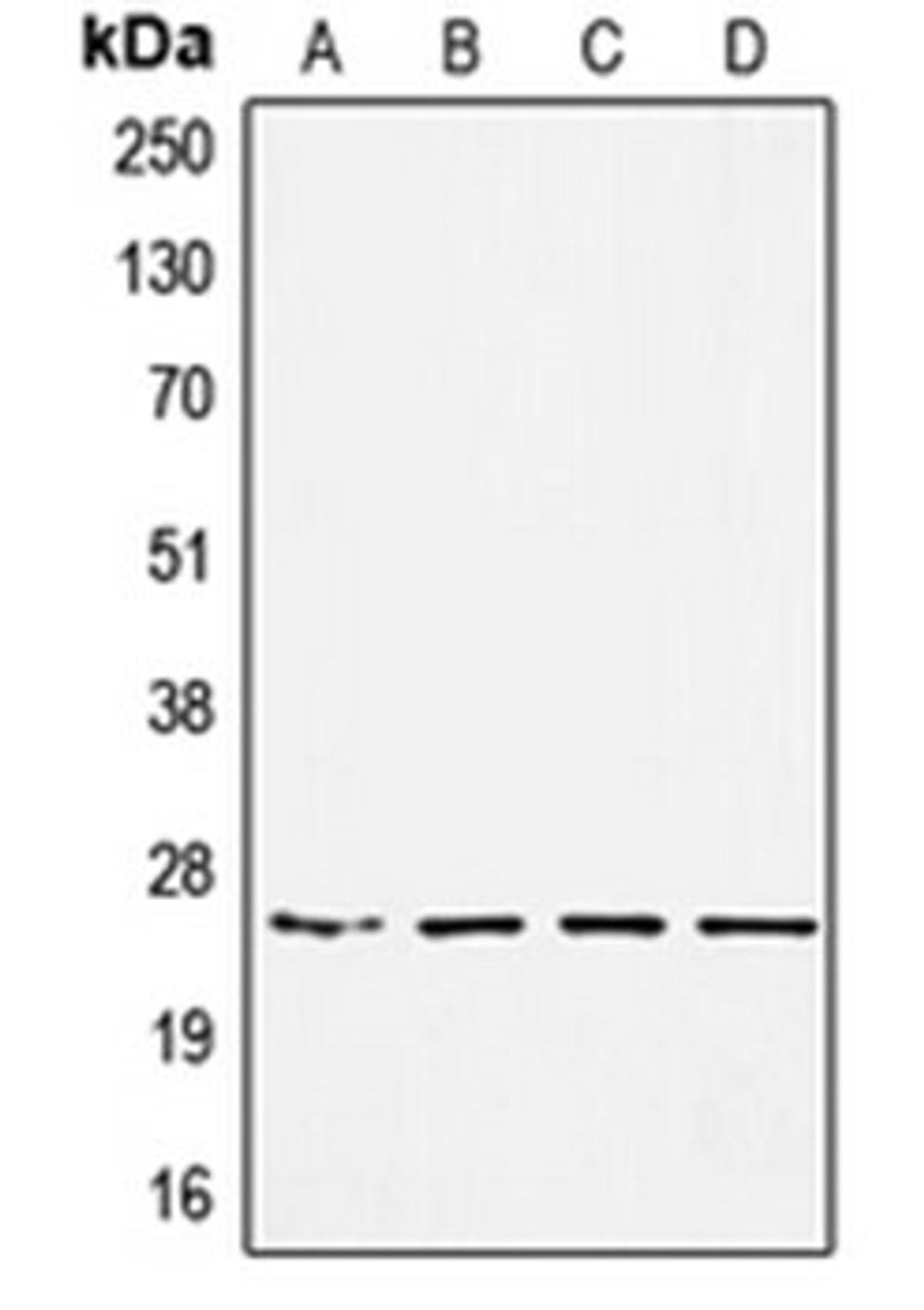 Western blot analysis of HEK293 (Lane 1), MDAMB453 (Lane 2), SW480 (Lane 3), A549 (Lane 4) whole cell lysates using SSX1 antibody