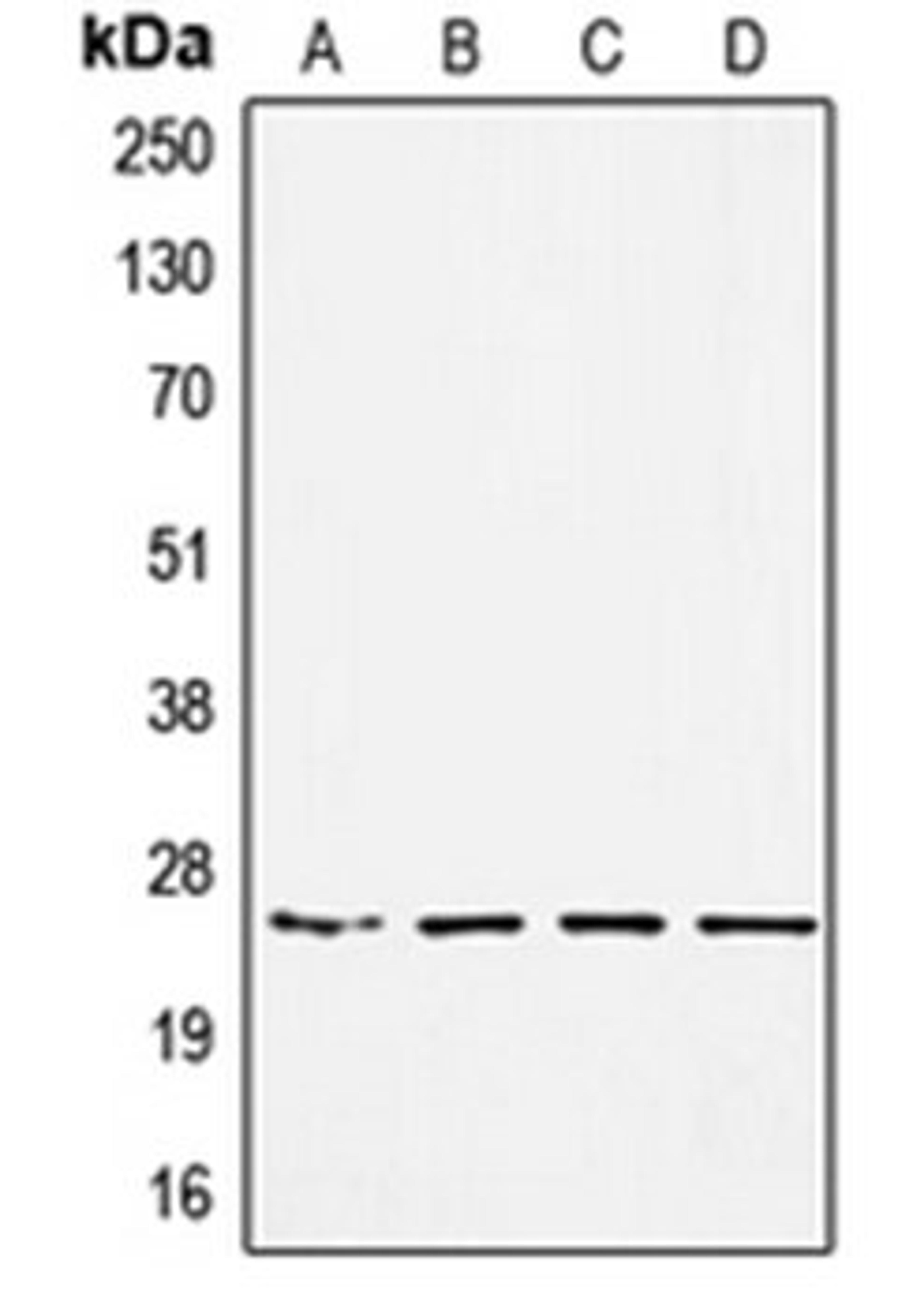 Western blot analysis of HEK293 (Lane 1), MDAMB453 (Lane 2), SW480 (Lane 3), A549 (Lane 4) whole cell lysates using SSX1 antibody