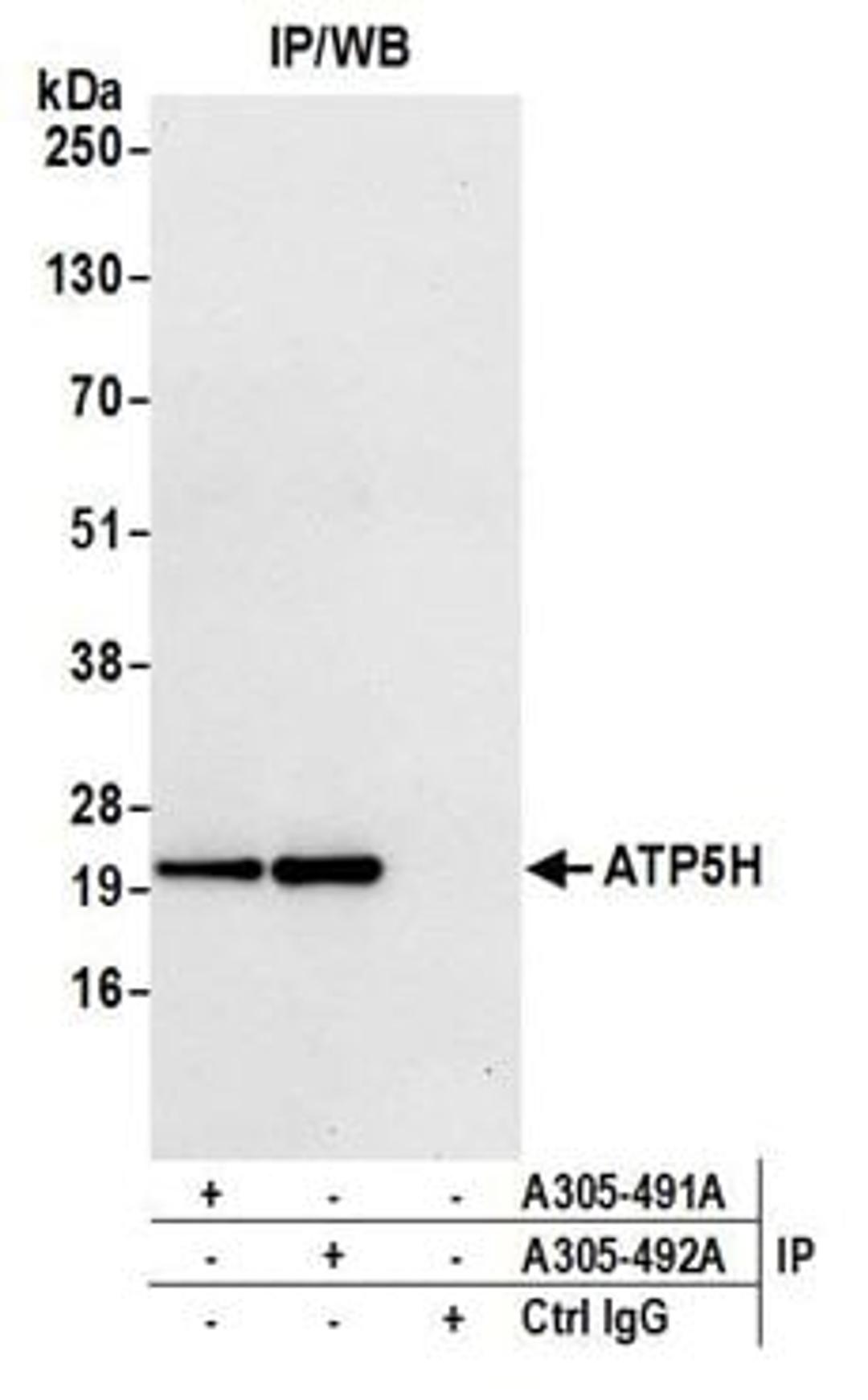 Detection of human ATP5H by western blot of immunoprecipitates.