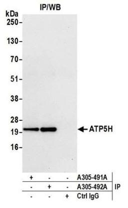 Detection of human ATP5H by western blot of immunoprecipitates.