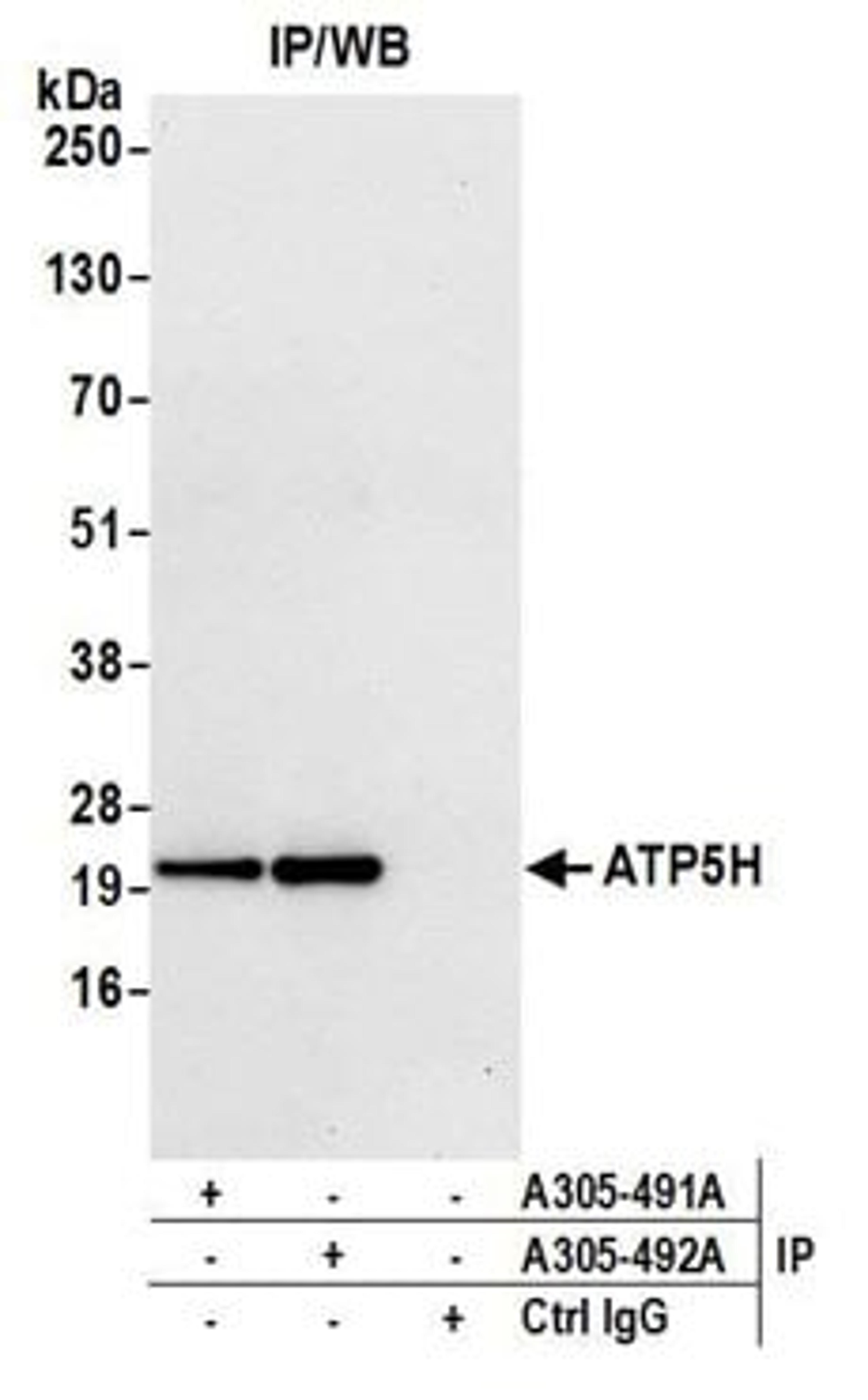 Detection of human ATP5H by western blot of immunoprecipitates.