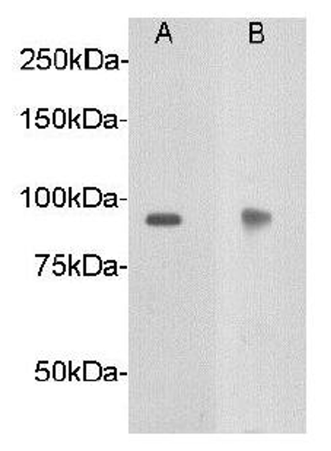 Western blot analysis of A: human brain tissue ,B: mouse brain tissue using Netrin receptor DCC antibody