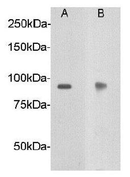 Western blot analysis of A: human brain tissue ,B: mouse brain tissue using Netrin receptor DCC antibody