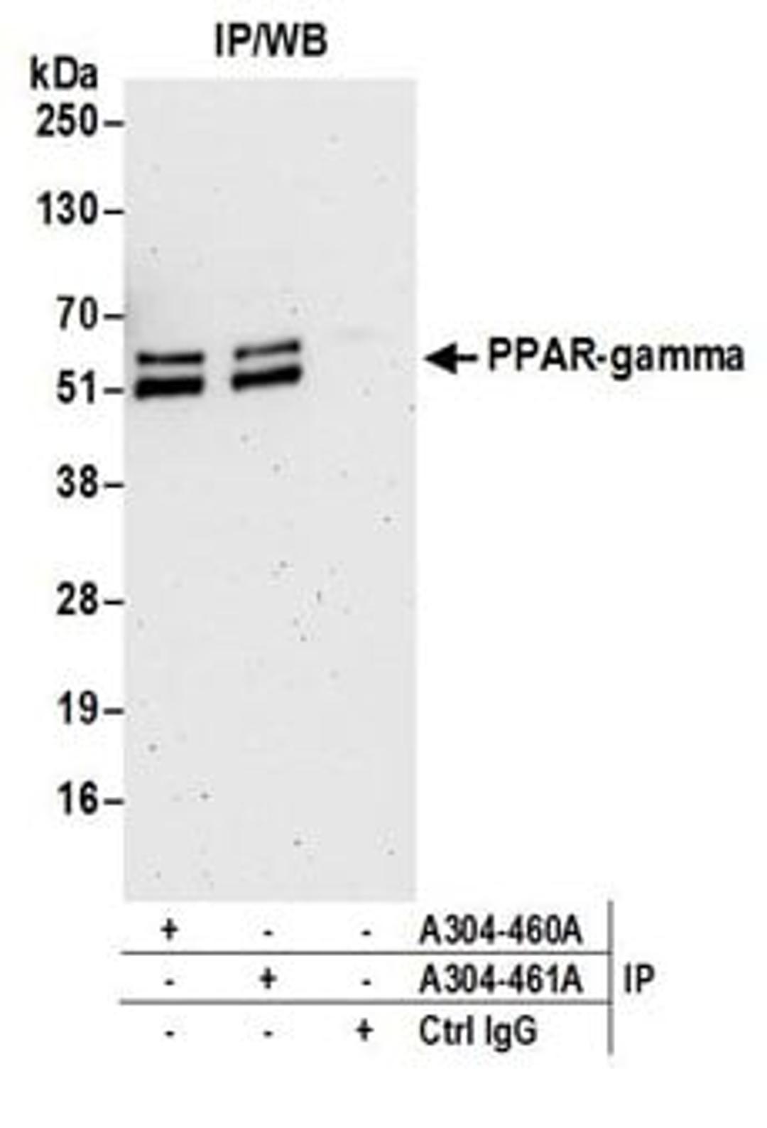 Detection of mouse PPAR-gamma by western blot of immunoprecipitates.