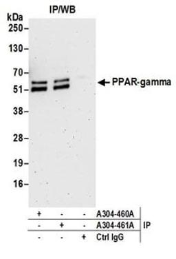 Detection of mouse PPAR-gamma by western blot of immunoprecipitates.