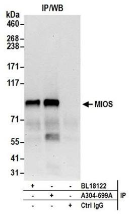 Detection of human MIOS by western blot of immunoprecipitates.