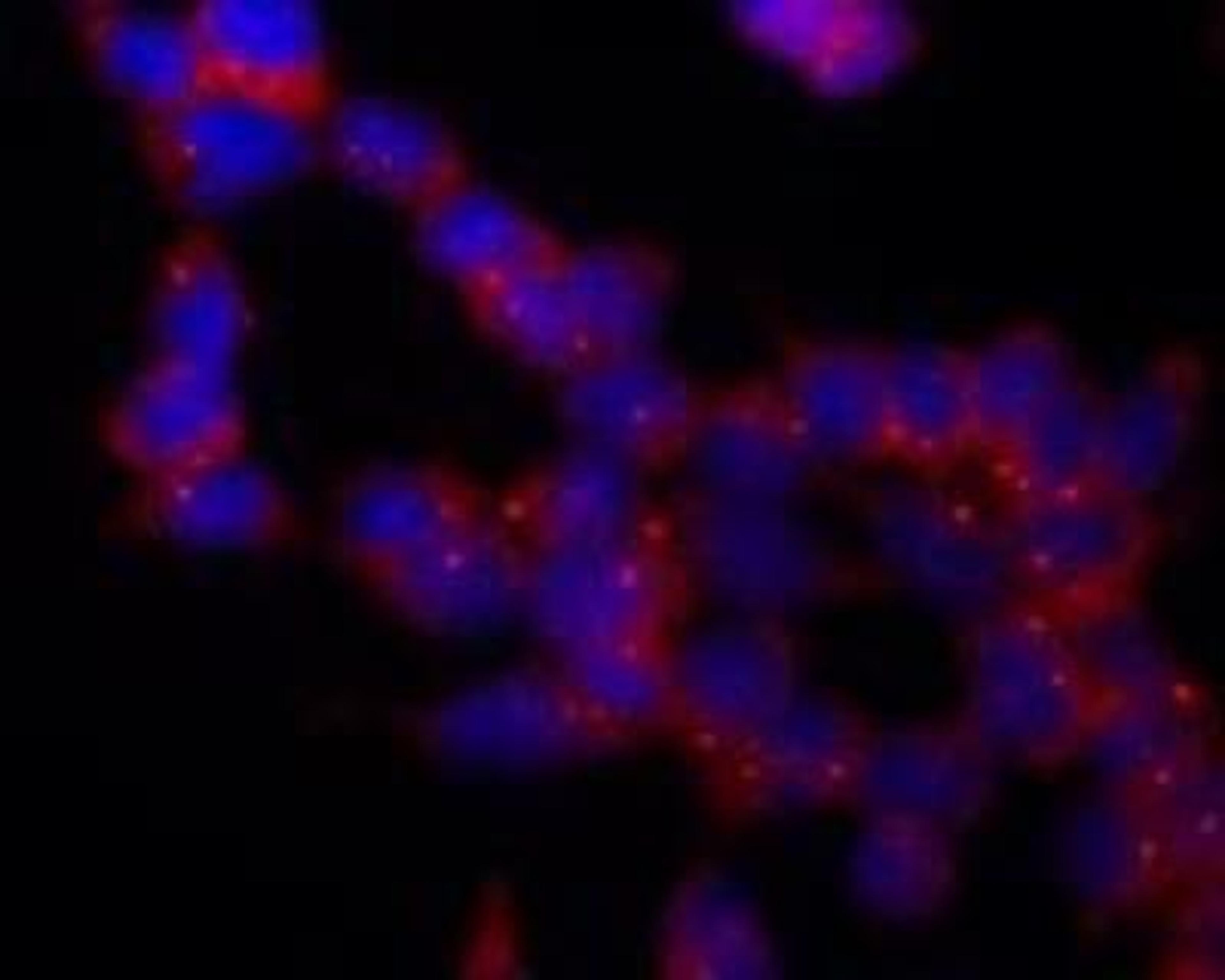 Immunocytochemistry/Immunofluorescence: gamma Tubulin Antibody (TU-30) [NB500-574] - Staining of P19X1 mouse embryonal carcinoma cell line using anti-gamma-tubulin (TU-30) (detection by secondary antibody Goat anti-mouse Cy3). Nuclei were stained with DAPI (blue).