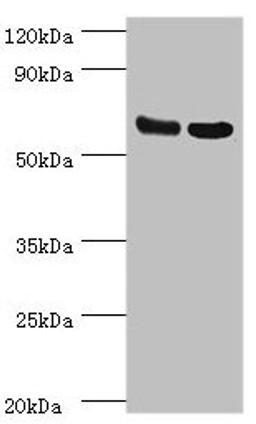 Western blot. All lanes: PDPK1 antibody at 2.5µg/ml. Lane 1: Hela whole cell lysate. Lane 2: A549 whole cell lysate. Secondary. Goat polyclonal to rabbit IgG at 1/10000 dilution. Predicted band size: 64, 59, 61, 49, 51 kDa. Observed band size: 64 kDa