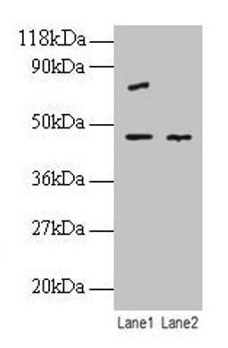 Western blot. All lanes: EIF4A2 antibody at 2µg/ml. Lane 1: EC109 whole cell lysate. Lane 2: 293T whole cell lysate. Secondary. Goat polyclonal to rabbit IgG at 1/10000 dilution. Predicted band size: 47 kDa. Observed band size: 47 kDa