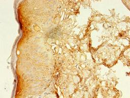Immunohistochemistry of paraffin-embedded human skin tissue using CSB-PA822677LA01HU at dilution of 1:100