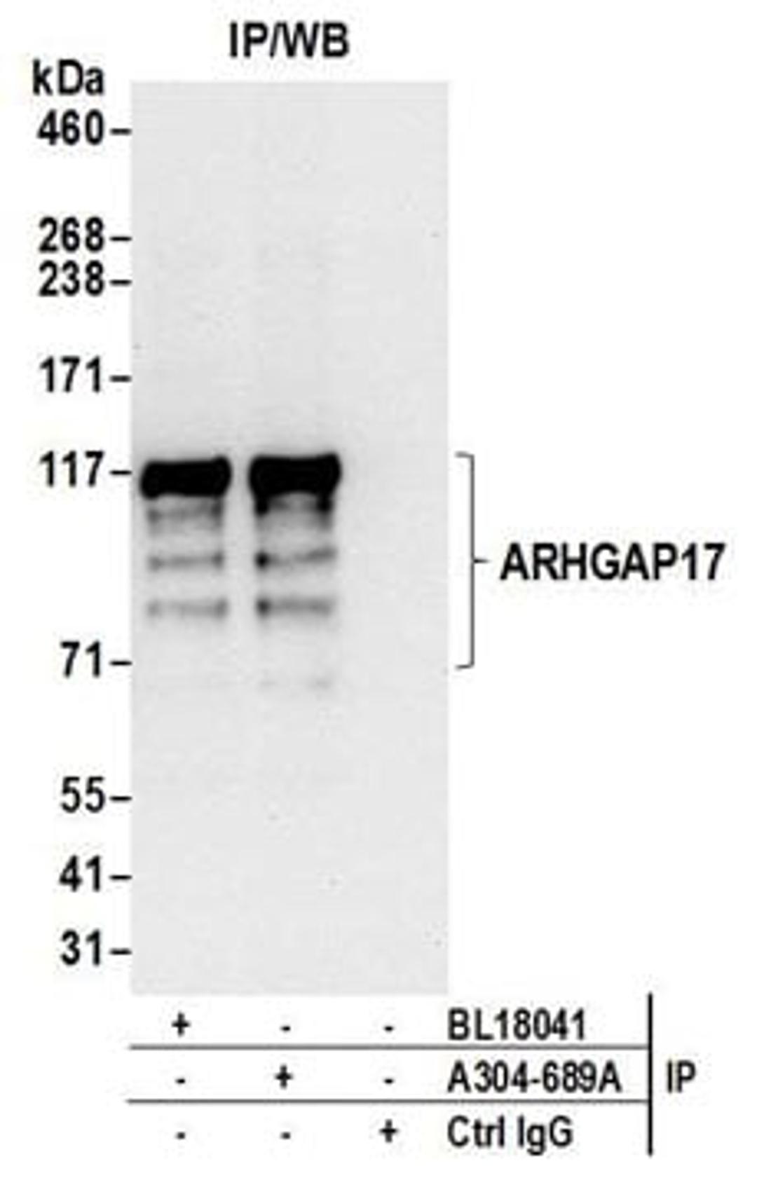 Detection of human ARHGAP17 by western blot of immunoprecipitates.