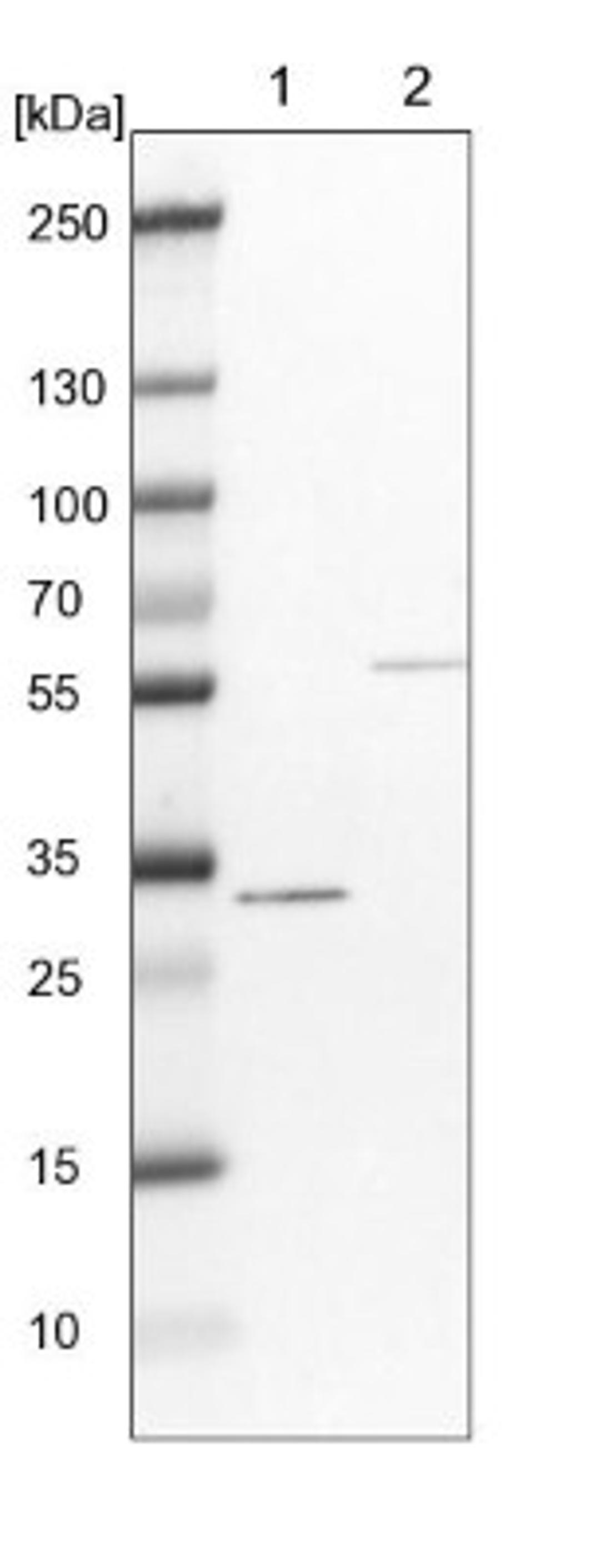 Western Blot: ESD Antibody [NBP1-89479] - Lane 1: NIH-3T3 cell lysate (Mouse embryonic fibroblast cells)<br/>Lane 2: NBT-II cell lysate (Rat Wistar bladder tumour cells)