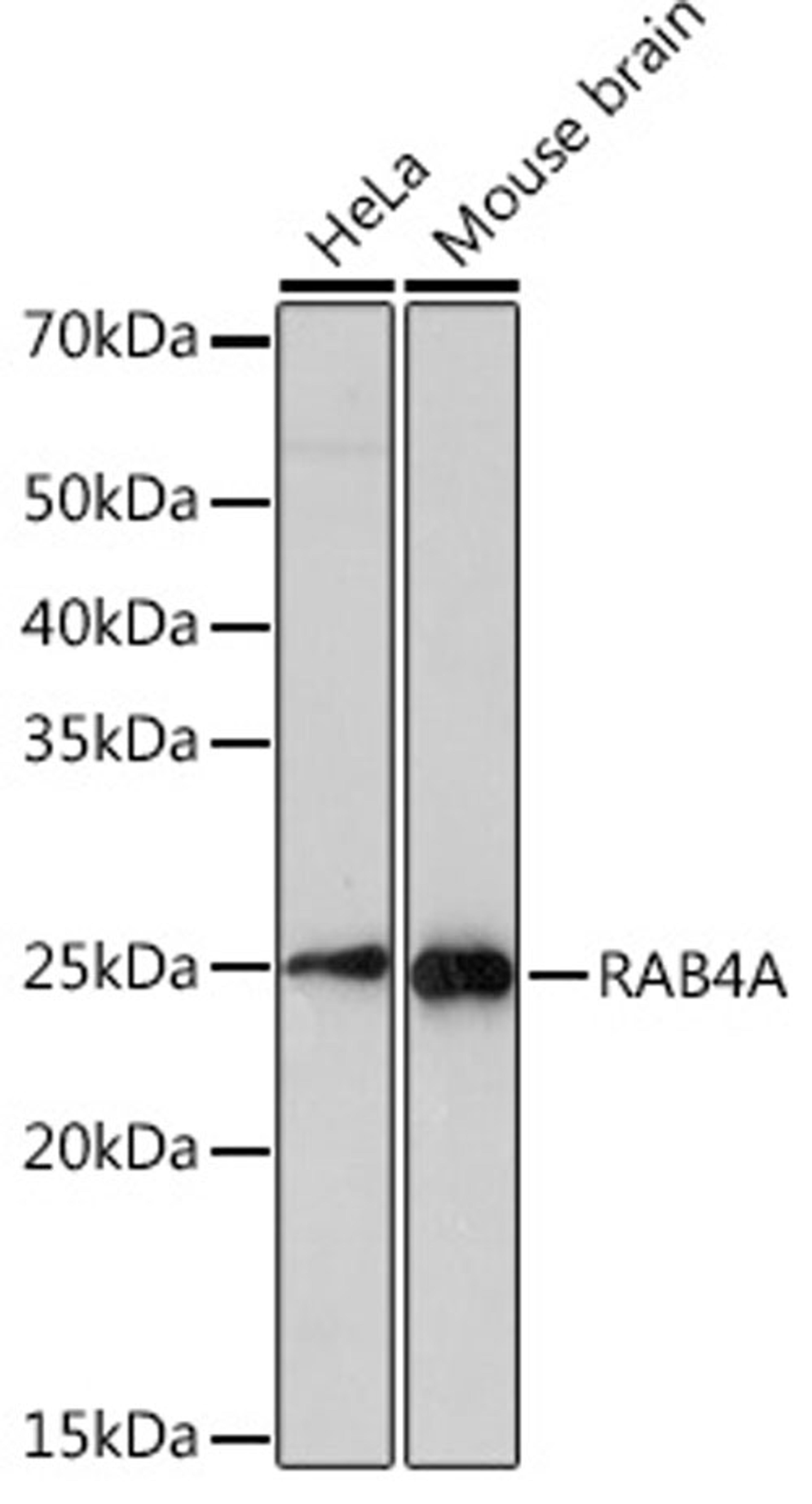 Western blot - RAB4A Rabbit mAb (A3979)