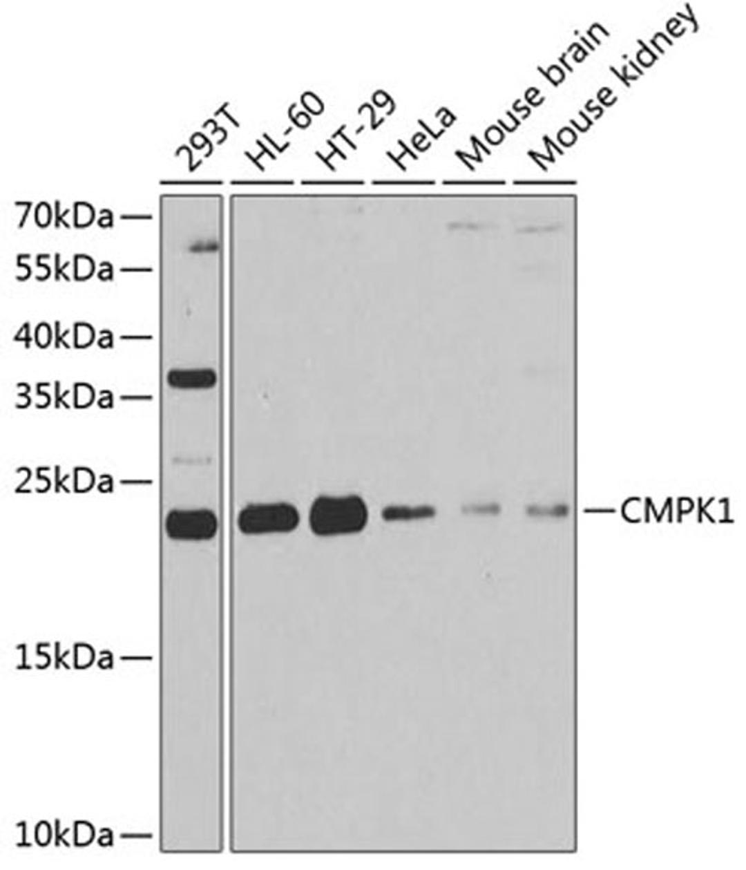 Western blot - CMPK1 antibody (A6561)