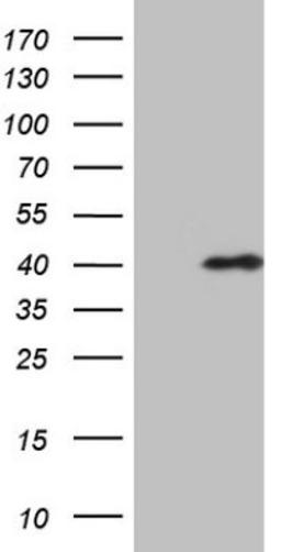 Western Blot: CHMP5 Antibody (5C7) [NBP2-46283] - Analysis of HEK293T cells were transfected with the pCMV6-ENTRY control (Left lane) or pCMV6-ENTRY CHMP5.