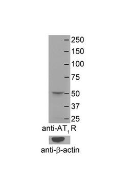 Antibody used in WB on Mouse Brain Membranes at 1:4000.