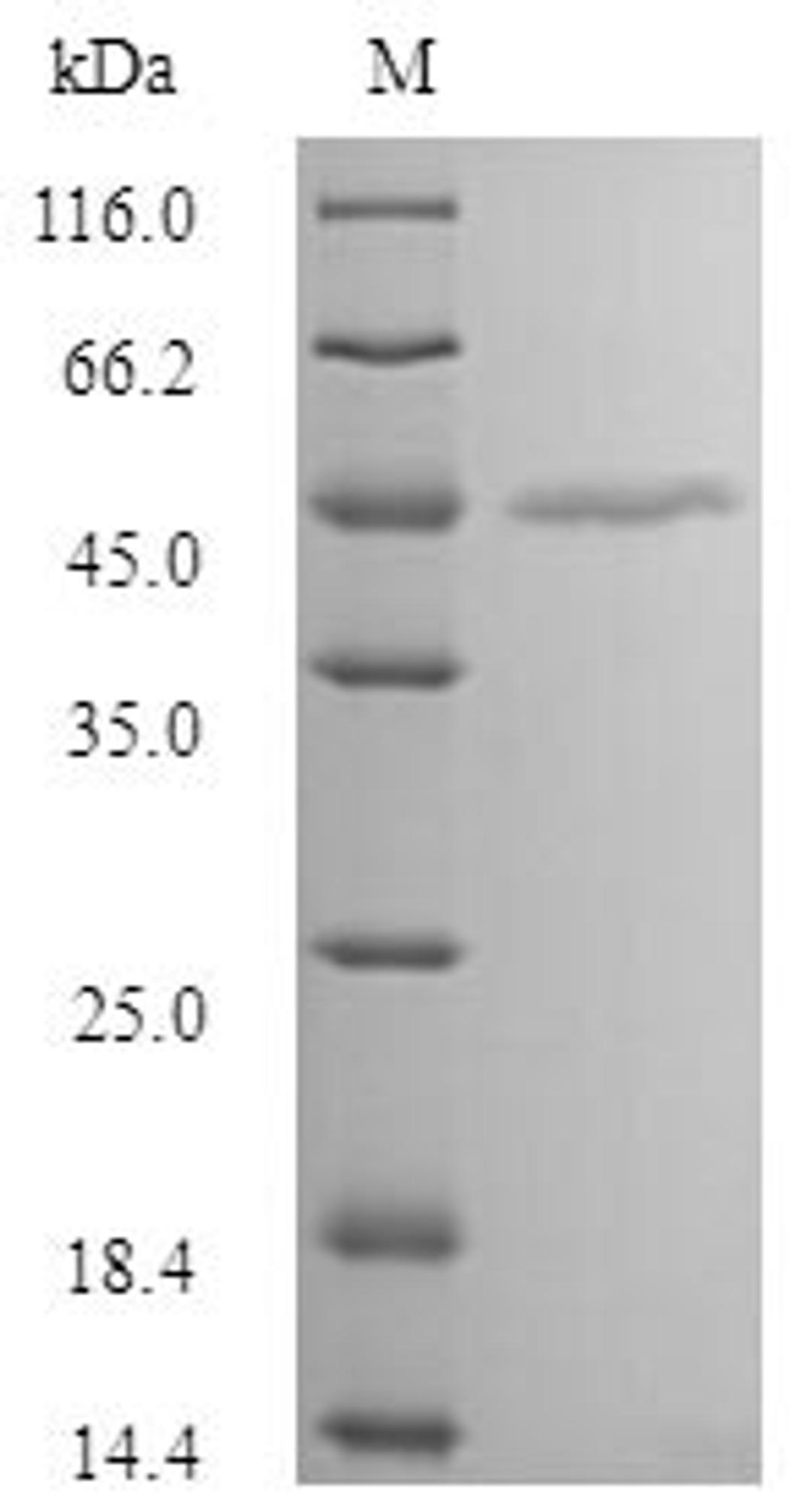 (Tris-Glycine gel) Discontinuous SDS-PAGE (reduced) with 5% enrichment gel and 15% separation gel.