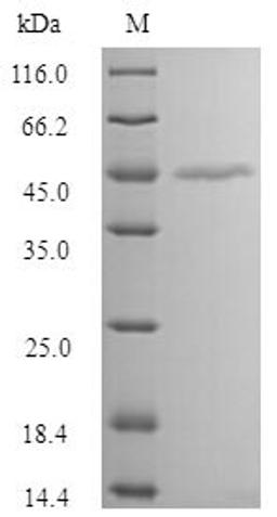 (Tris-Glycine gel) Discontinuous SDS-PAGE (reduced) with 5% enrichment gel and 15% separation gel.
