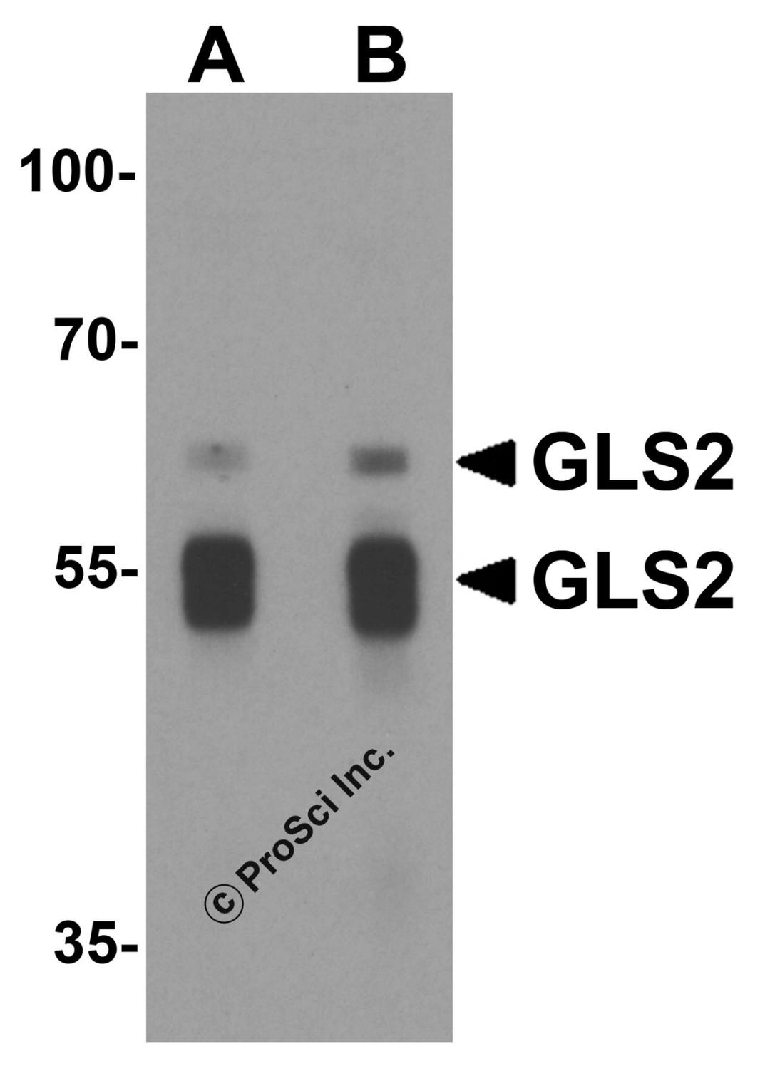 Western blot analysis of GLS2 in rat liver tissue lysate with GLS2 antibody at (A) 1 and (B) 2 μg/mL.