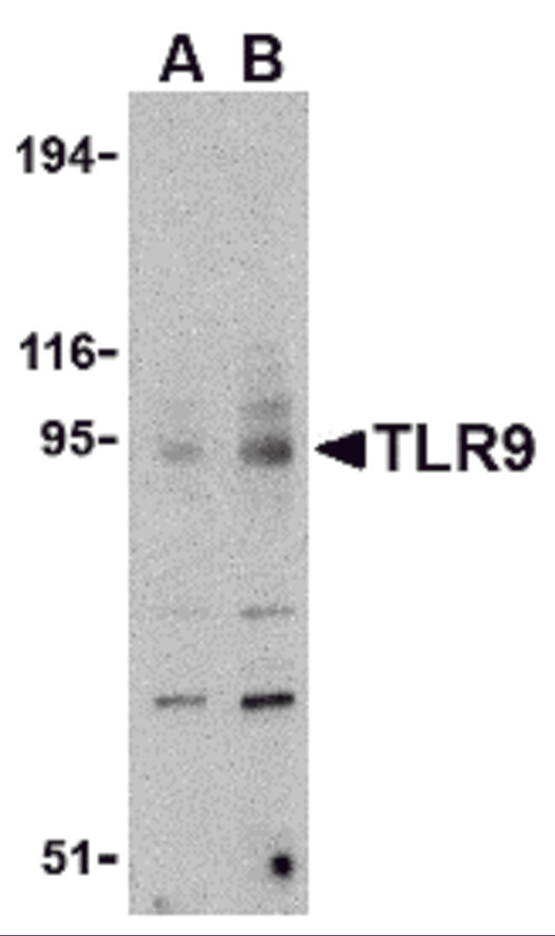 Western blot analysis of TLR9 in mouse spleen cell lysate with TLR9 antibody at (A) 0.5 and (B) 1 &#956;g/mL.