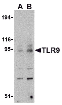 Western blot analysis of TLR9 in mouse spleen cell lysate with TLR9 antibody at (A) 0.5 and (B) 1 &#956;g/mL.