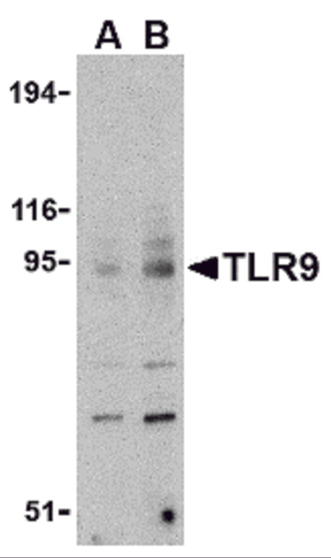 Western blot analysis of TLR9 in mouse spleen cell lysate with TLR9 antibody at (A) 0.5 and (B) 1 μg/mL.