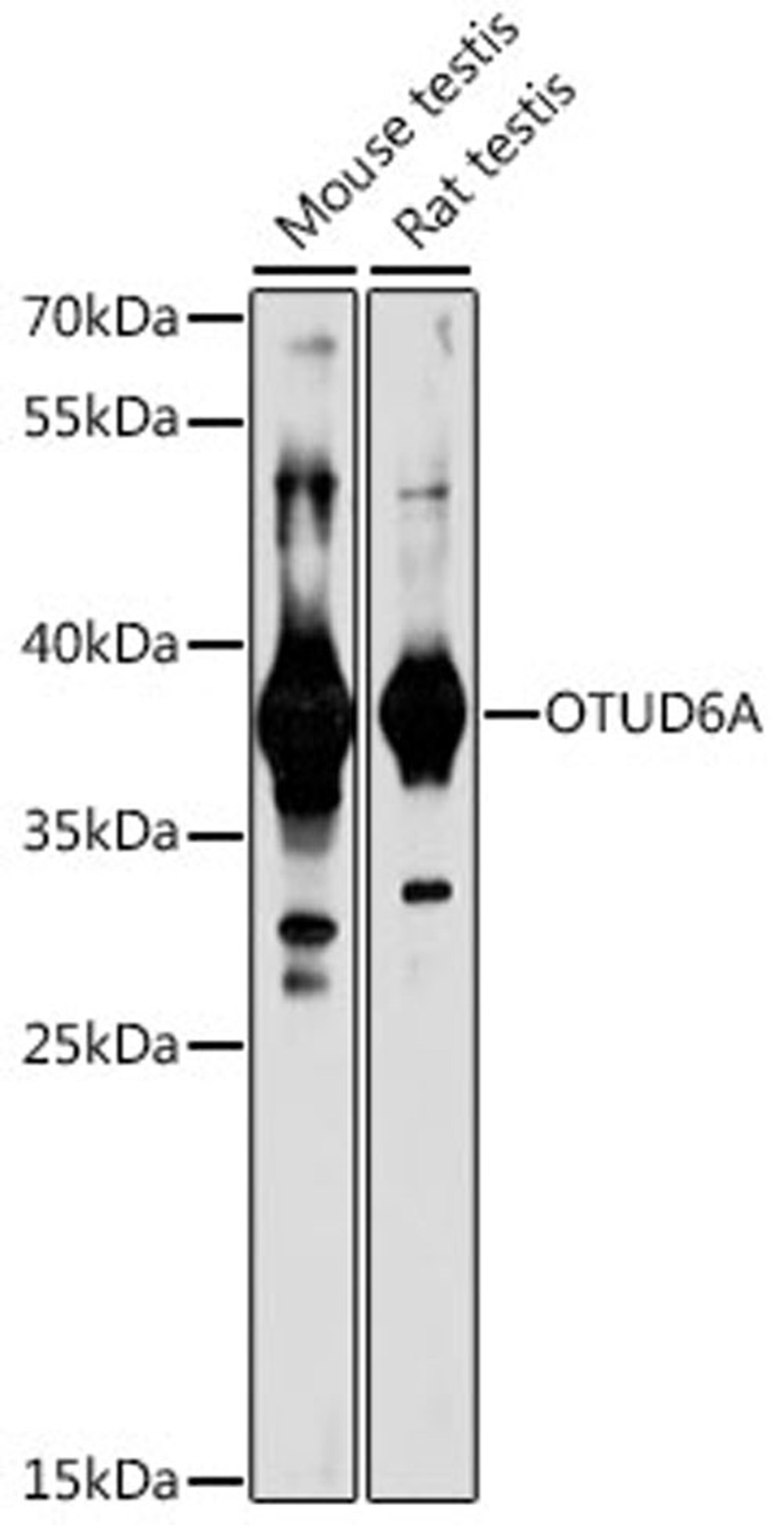 Western blot - OTUD6A antibody (A16628)