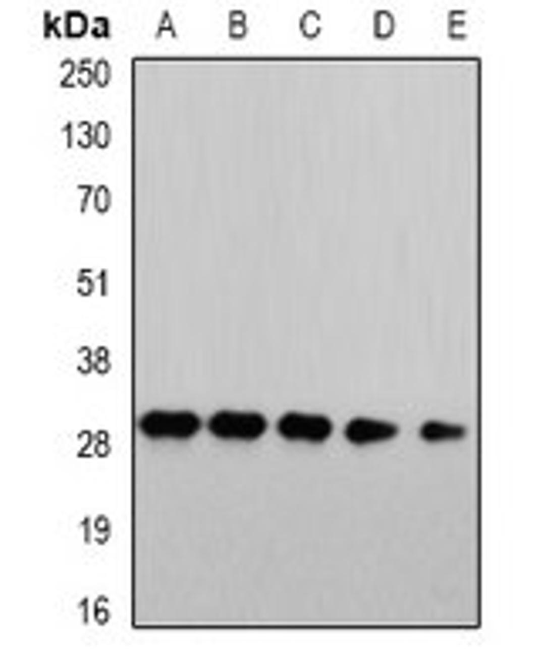 Western blot analysis of HepG2 (Lane1), Jurkat (Lane2), mouse liver (Lane3), COS7 (Lane4), PC12 (Lane5) whole cell lysates using PSMA4 antibody