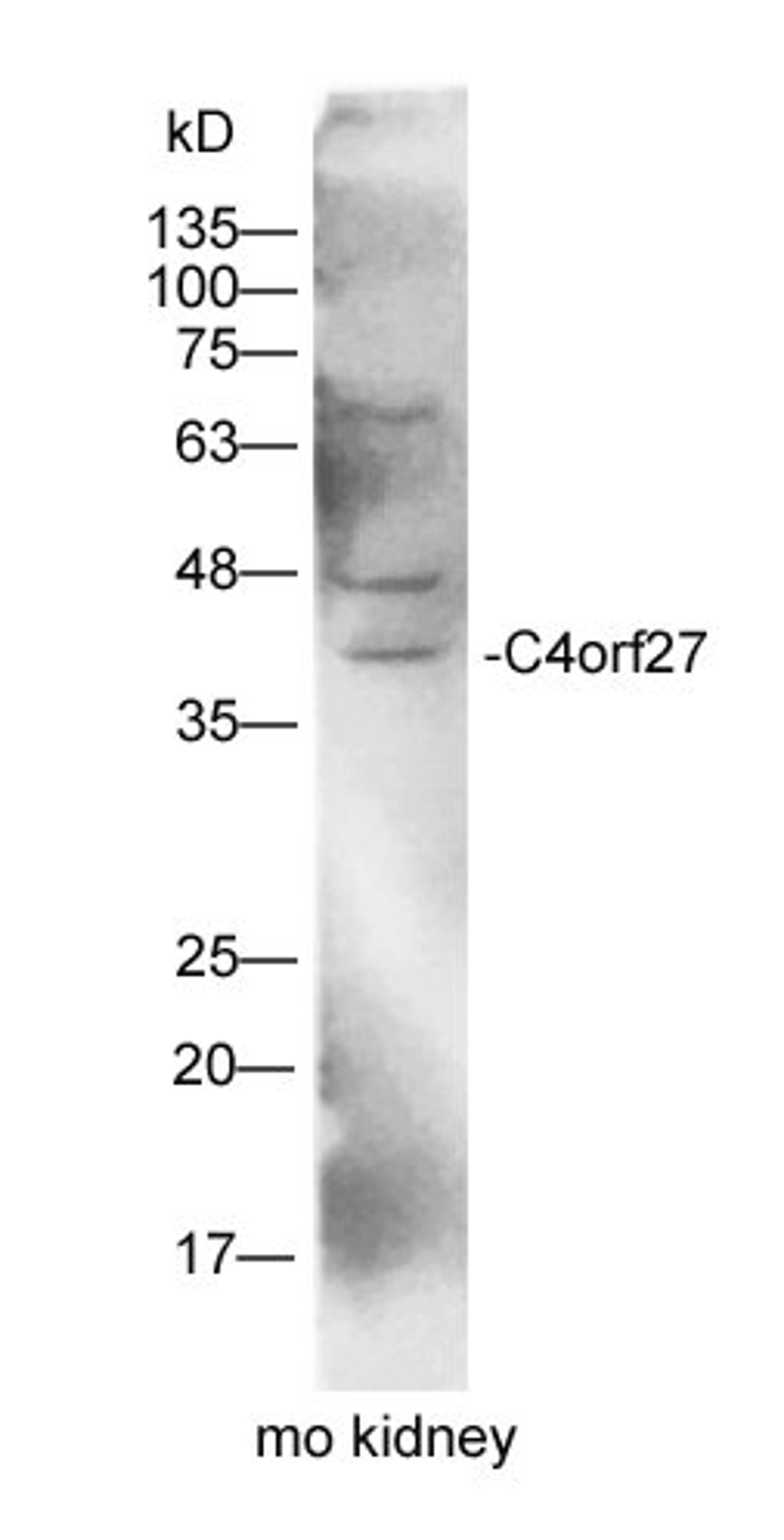 WB analysis of mouse kidney tissue using C4orf27 antibody