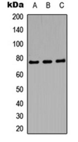 Western blot analysis of SHSYS5 (Lane 1), mouse brain (Lane 2), PC12 (Lane 3) whole cell lysates using Amphiphysin 1 antibody