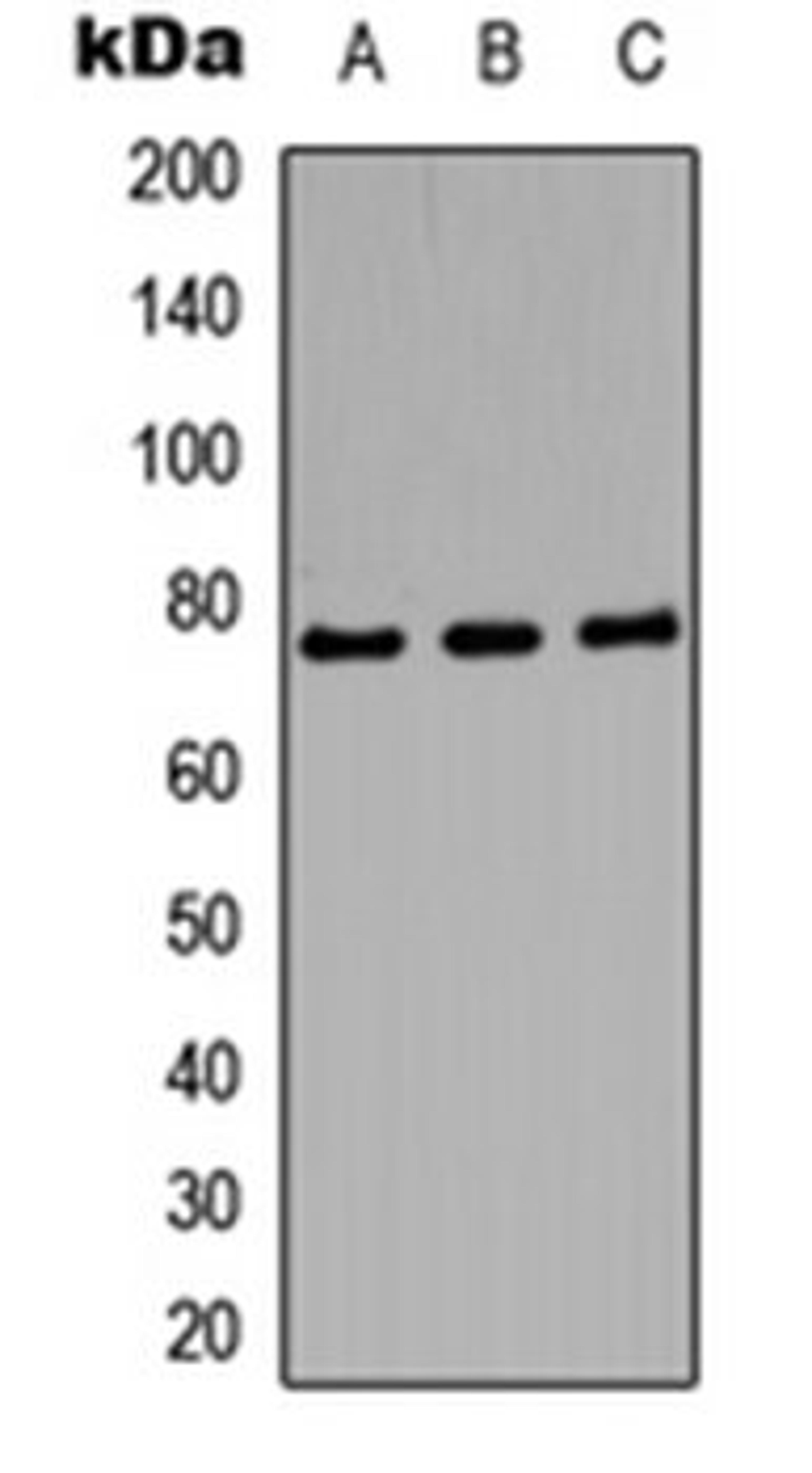 Western blot analysis of SHSYS5 (Lane 1), mouse brain (Lane 2), PC12 (Lane 3) whole cell lysates using Amphiphysin 1 antibody