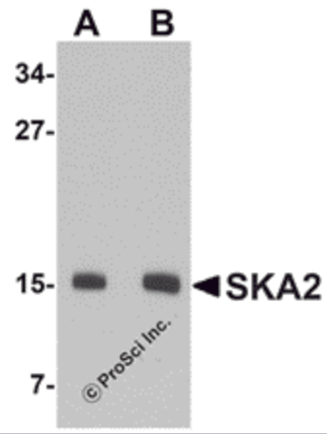 Western blot analysis of SKA2 in 3T3 cell lysate with SKA2 antibody at (A) 0.5 and (B) 1 μg/mL.