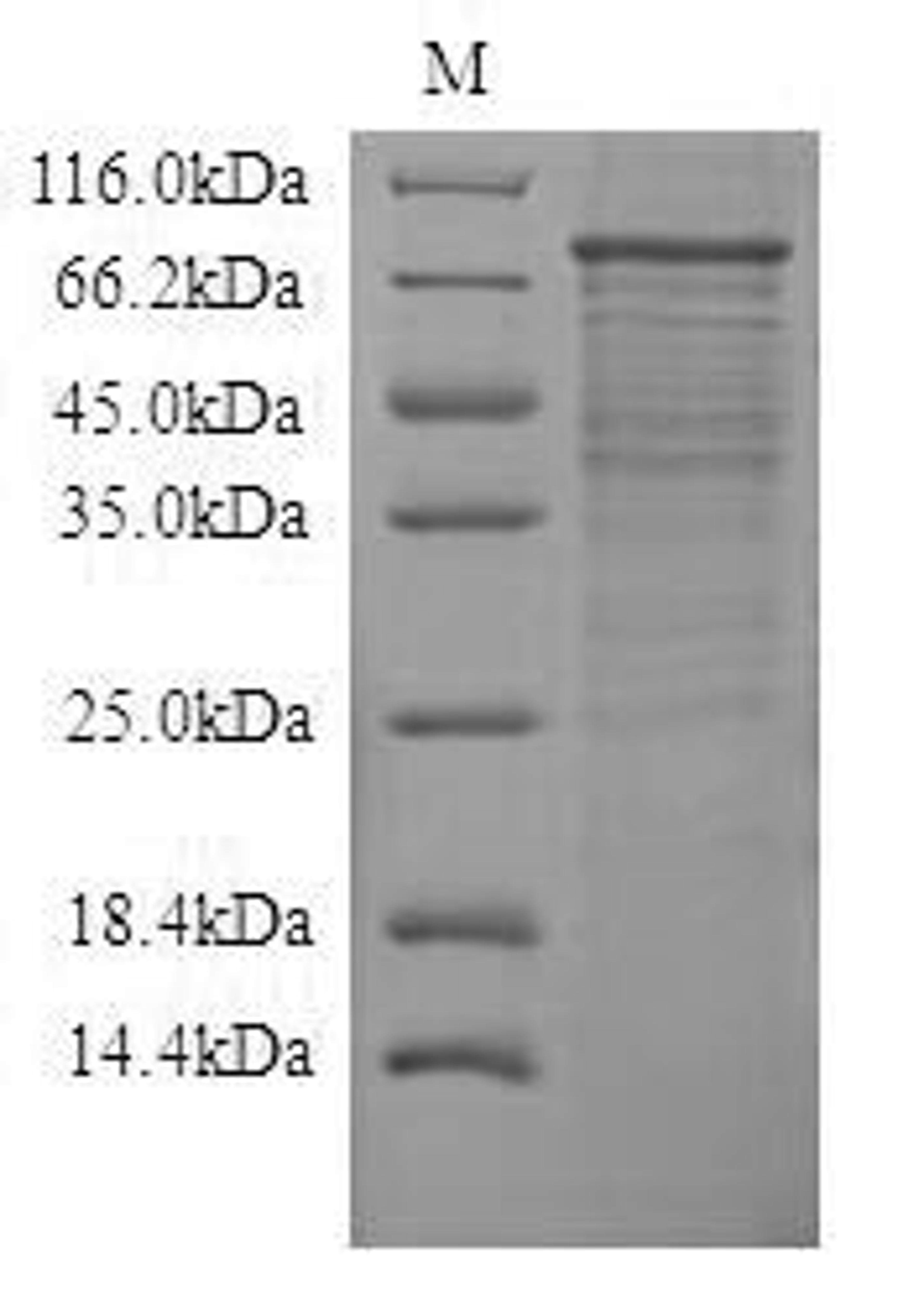 (Tris-Glycine gel) Discontinuous SDS-PAGE (reduced) with 5% enrichment gel and 15% separation gel.