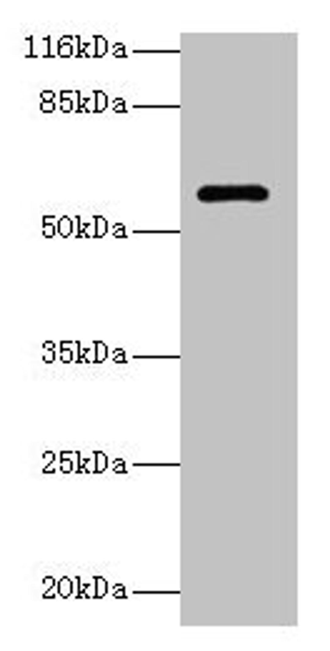Western blot. All lanes: GK3P antibody at 2µg/ml + Hela whole cell lysate. Secondary. Goat polyclonal to rabbit IgG at 1/10000 dilution. Predicted band size: 61 kDa. Observed band size: 61 kDa