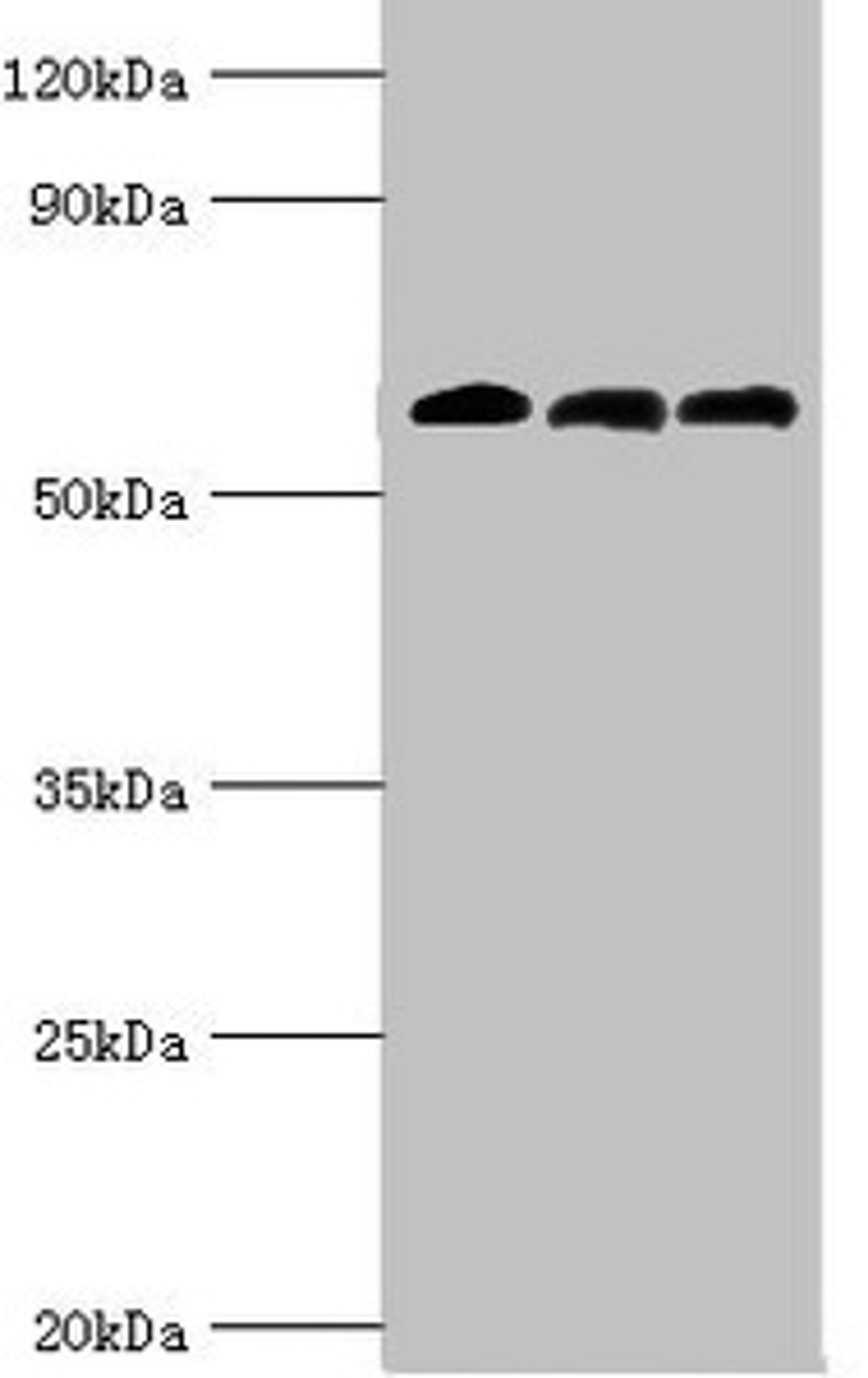 Western blot. All lanes: 4-aminobutyrate aminotransferase, mitochondrial antibody at 10ug/ml. Lane 1: Rat liver tissue. Lane 2: Mouse pancreatic tissue. Lane 3: Mouse kidney tissue. Secondary. Goat polyclonal to rabbit IgG at 1/10000 dilution. Predicted band size: 56 kDa. Observed band size: 56 kDa. 
