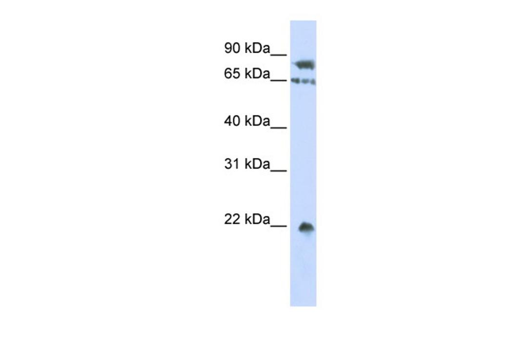 Antibody used in WB on Human HepG2 at 0.2-1 ug/ml.