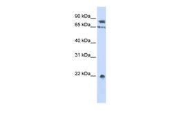 Antibody used in WB on Human HepG2 at 0.2-1 ug/ml.