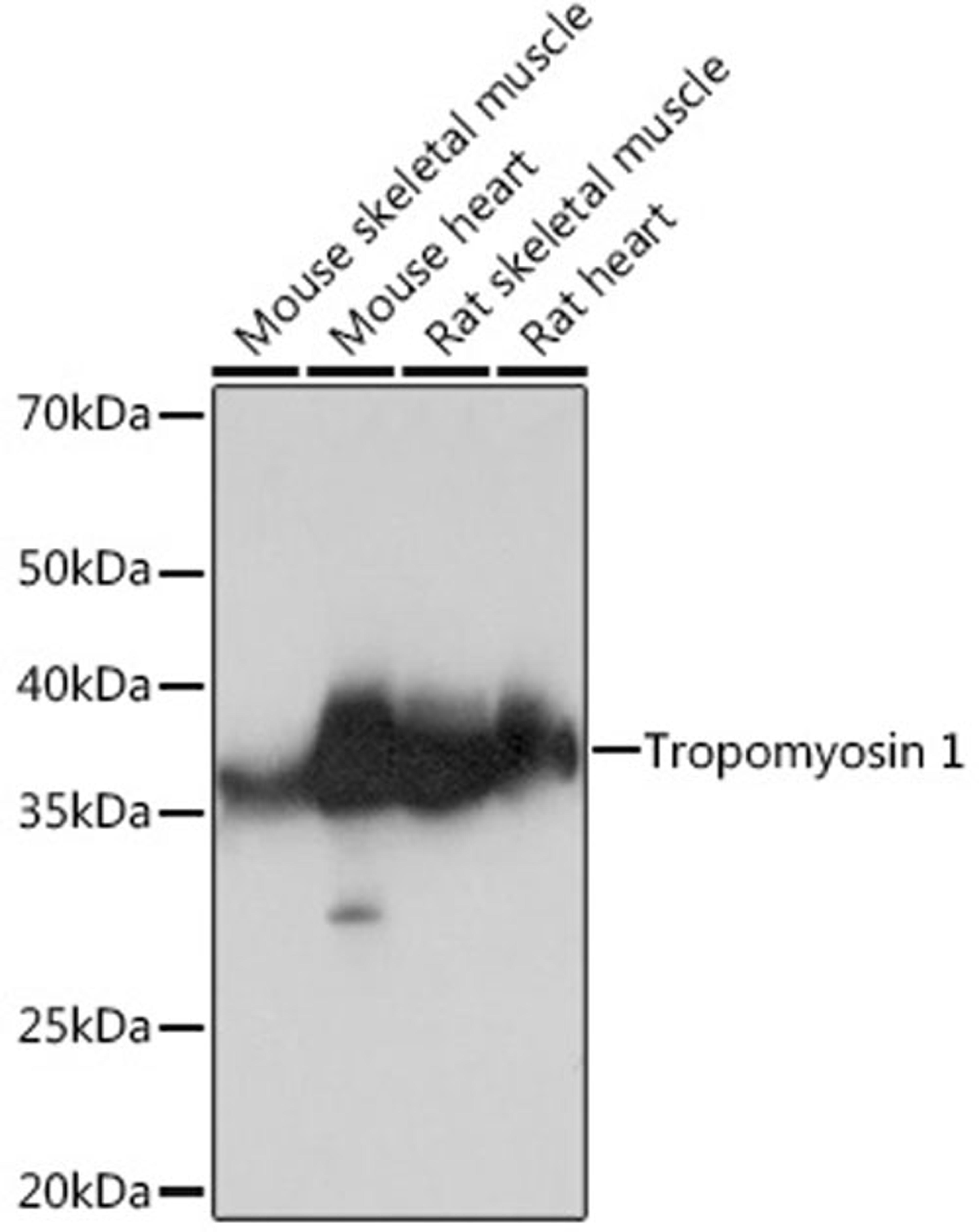 Western blot - Tropomyosin 1 Rabbit mAb (A8723)