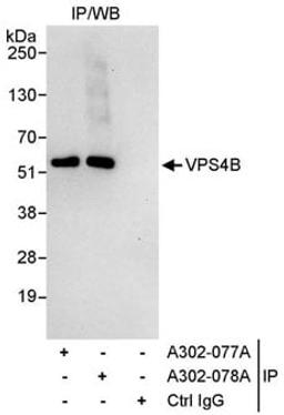 Detection of human VPS4B by western blot of immunoprecipitates.