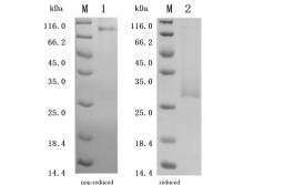 (Tris-Glycine gel) Discontinuous SDS-PAGE (reduced/non-reduced) with 5% enrichment gel and 15% separation gel.