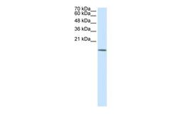 Antibody used in WB on Human 293T at 0.2-1 ug/ml.