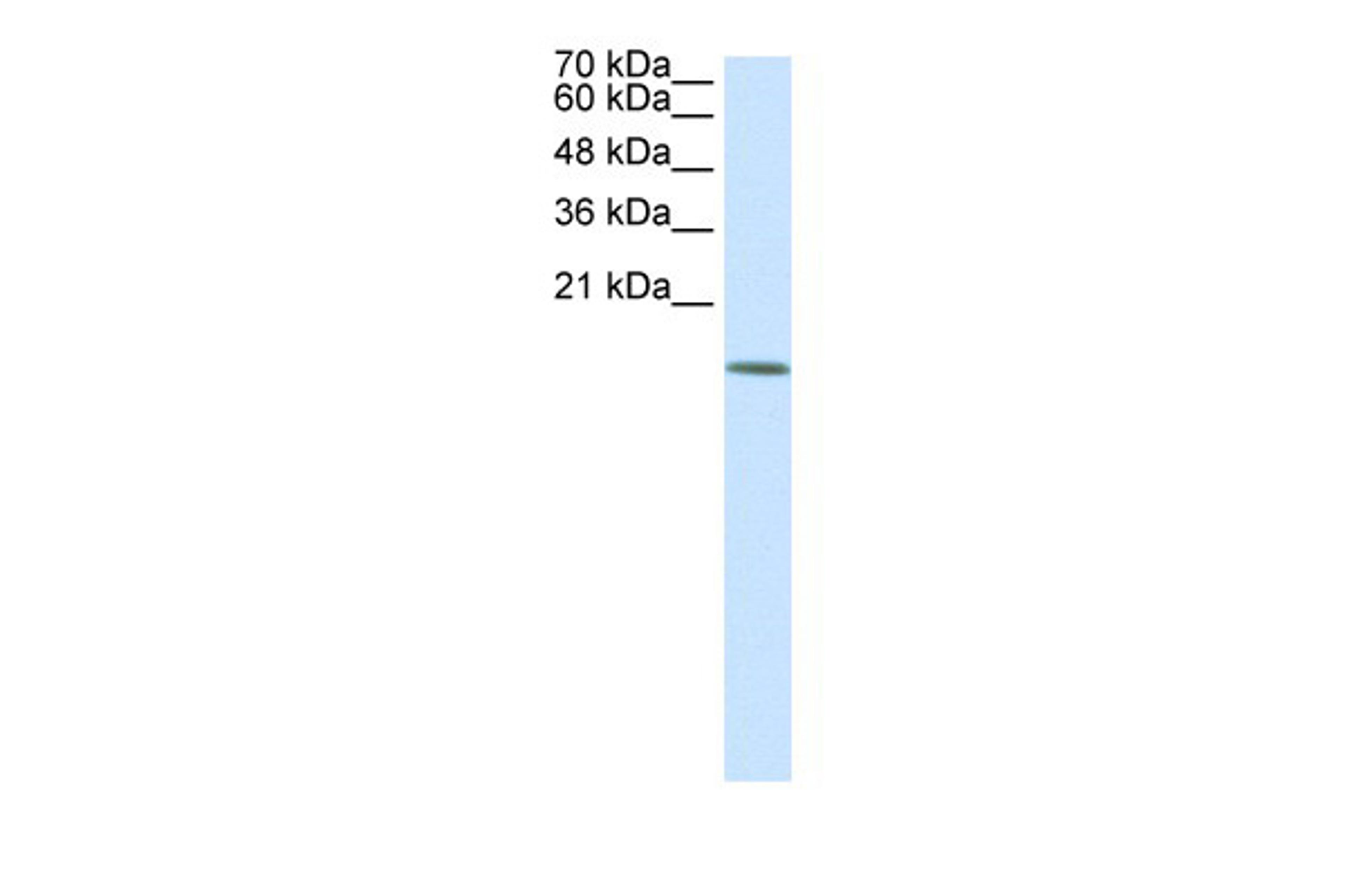 Antibody used in WB on Human 293T at 0.2-1 ug/ml.