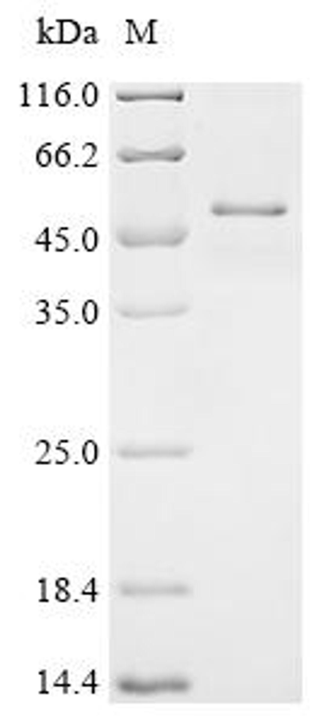 (Tris-Glycine gel) Discontinuous SDS-PAGE (reduced) with 5% enrichment gel and 15% separation gel.
