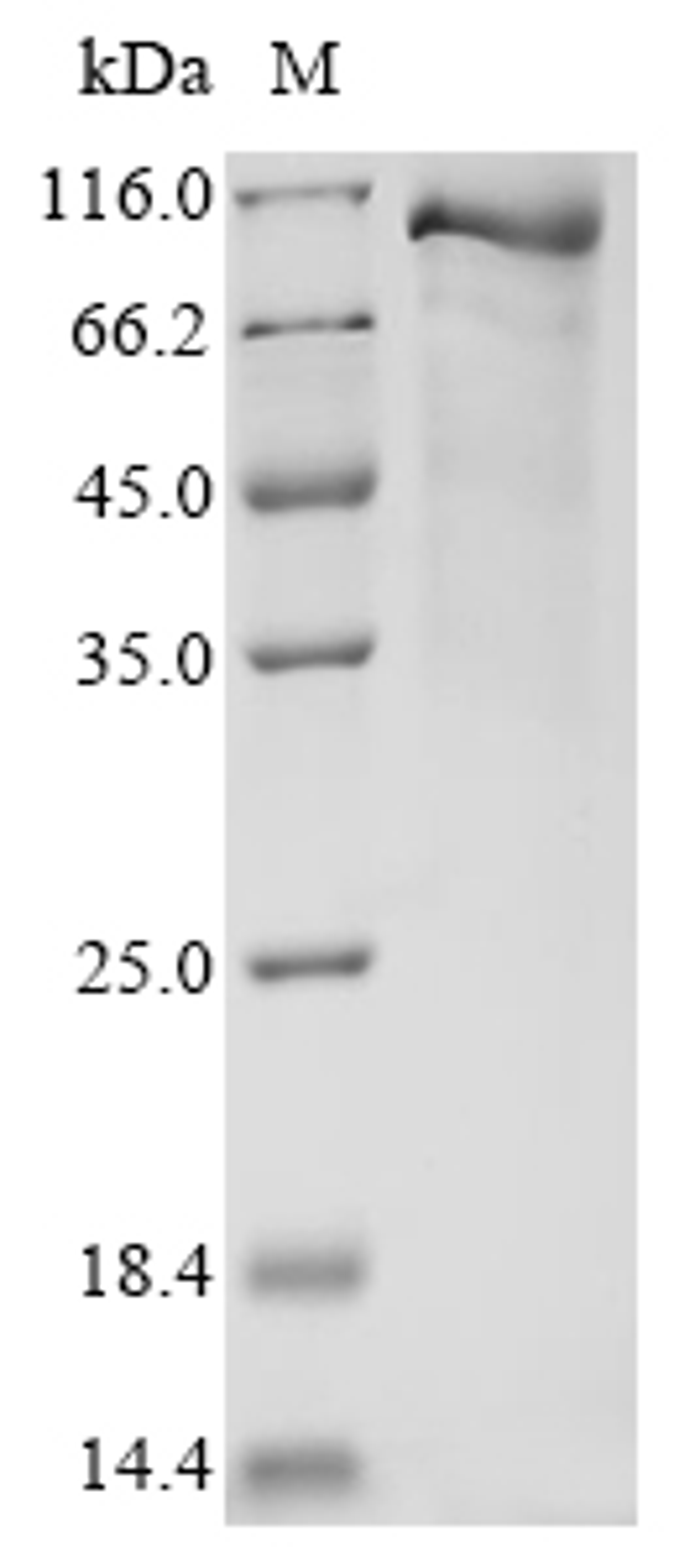 (Tris-Glycine gel) Discontinuous SDS-PAGE (reduced) with 5% enrichment gel and 15% separation gel.